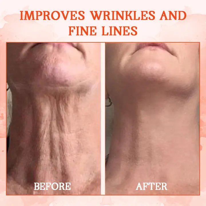 ðžð§ððð¬ð ððð² ðð¢ð¬ððšð®ð§ð: ðð% ðð
ð
Furzero® SkinFirming Rejuvenating Cream
