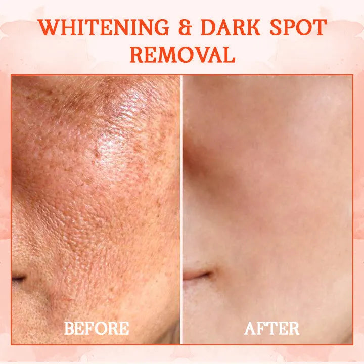 ðžð§ððð¬ð ððð² ðð¢ð¬ððšð®ð§ð: ðð% ðð
ð
Furzero® SkinFirming Rejuvenating Cream