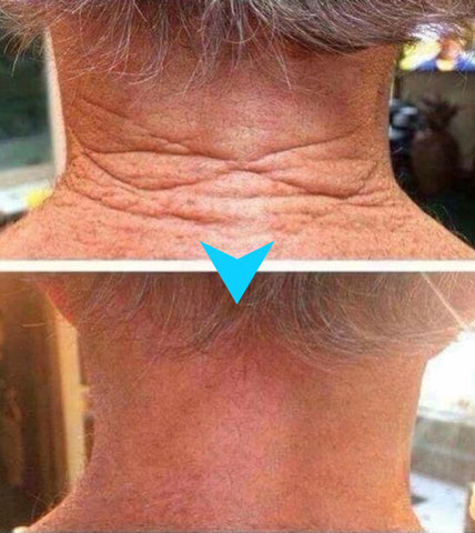 ðžð§ððð¬ð ððð² ðð¢ð¬ððšð®ð§ð: ðð% ðð
ð
Furzero® SkinFirming Rejuvenating Cream