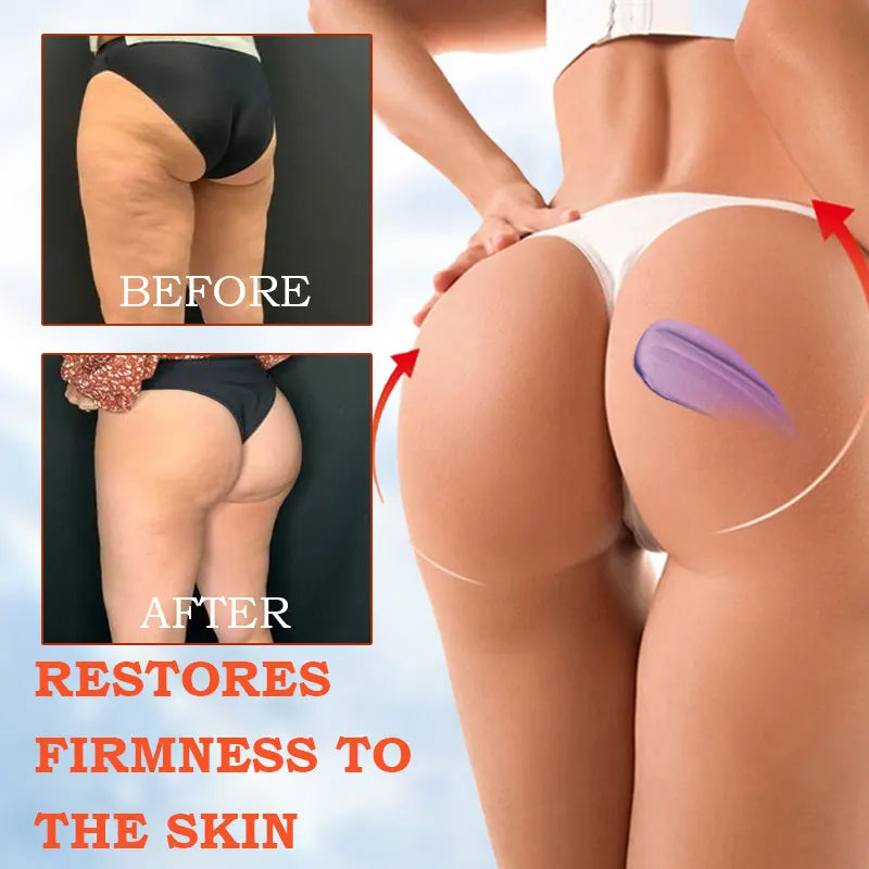 ðžð§ððð¬ð ððð² ðð¢ð¬ððšð®ð§ð: ðð% ðð
ð
Furzero® SkinFirming Rejuvenating Cream