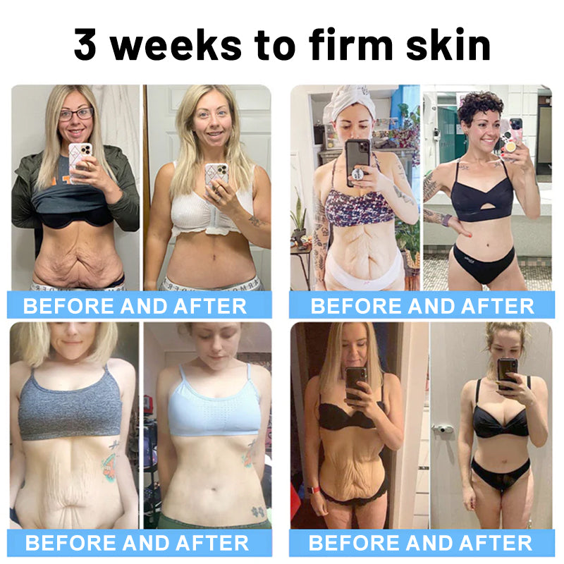 🏙️Flysmus® Skin Firming Cream,Addressing Crepe & Sagging