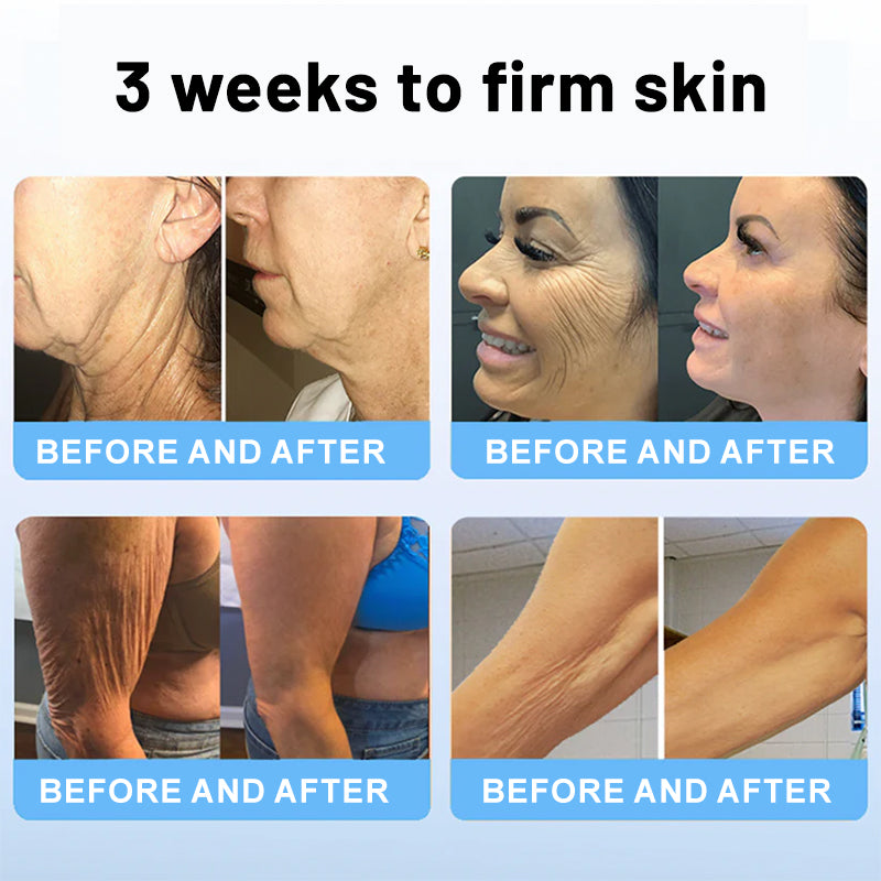 🏙️Flysmus® Skin Firming Cream,Addressing Crepe & Sagging