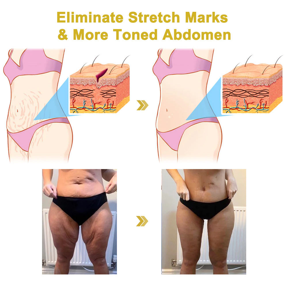 🏙️Flysmus® Skin Firming Cream,Addressing Crepe & Sagging