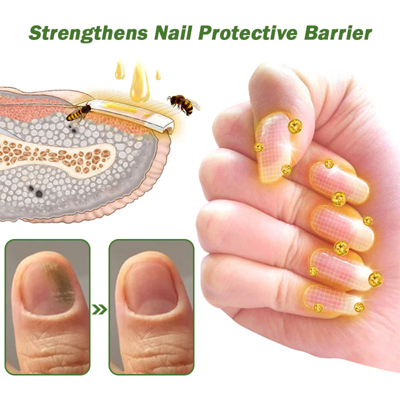 👩⚕️☁️Furzero™ Nail Defense Bee Venom Treatment Serum(For All Kinds Of Nail Diseases✅For Healthier Nail Growth)