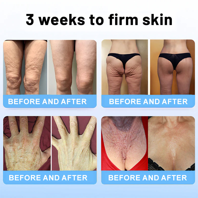 🏙️Flysmus® Skin Firming Cream,Addressing Crepe & Sagging