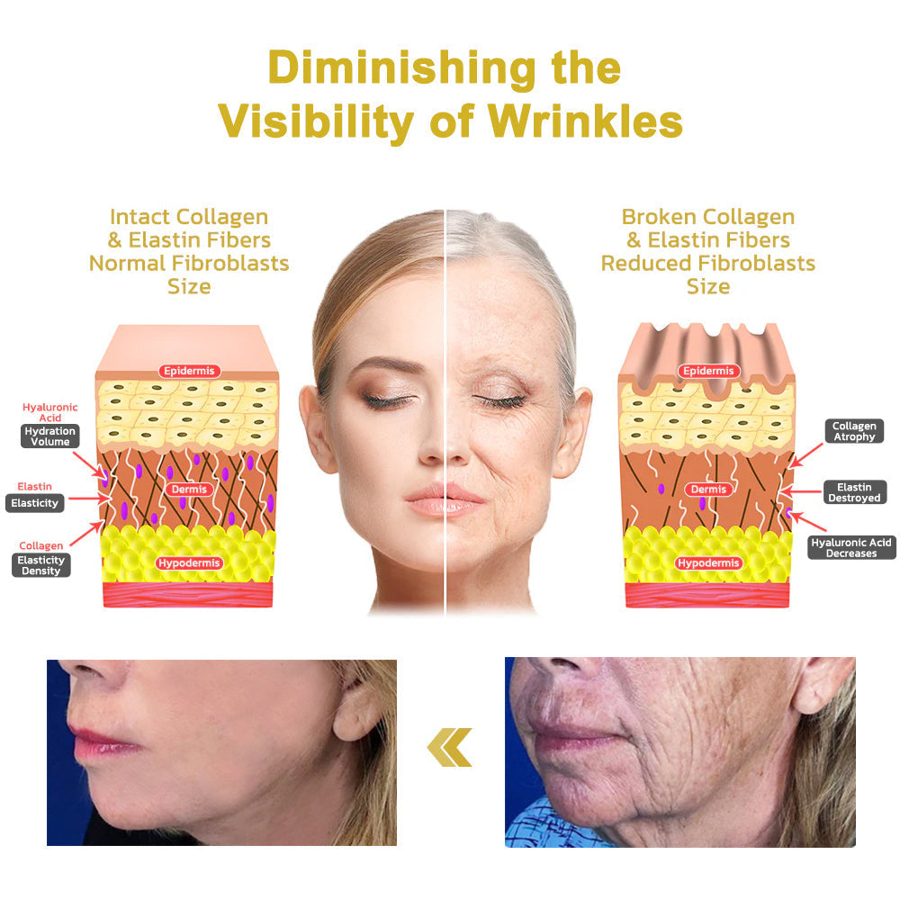 🏙️Flysmus® Skin Firming Cream,Addressing Crepe & Sagging