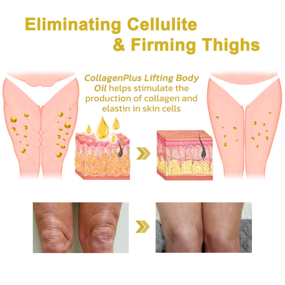 🏙️Flysmus® Skin Firming Cream,Addressing Crepe & Sagging