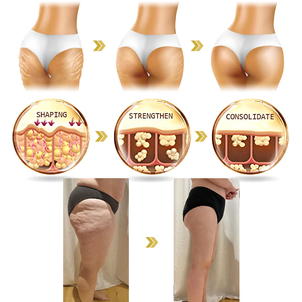 🏙️Flysmus® Skin Firming Cream,Addressing Crepe & Sagging