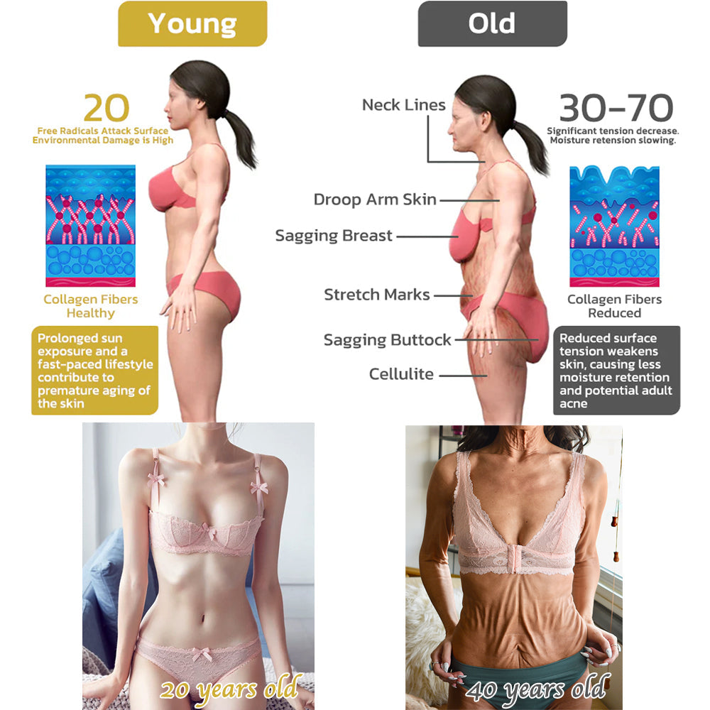 🏙️Flysmus® Skin Firming Cream,Addressing Crepe & Sagging