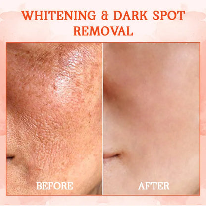 🐸💧𝐋𝐚𝐬𝐭 𝐃𝐚𝐲 𝐃𝐢𝐬𝐜𝐨𝐮𝐧𝐭: 𝟕𝟎% 𝐎𝐅𝐅 Furzero® SkinFirming Rejuvenating Cream