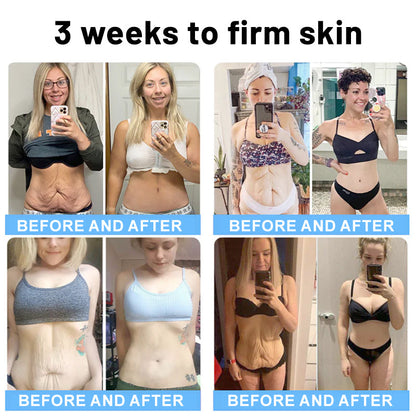 ⛲Flysmus® Skin Firming Cream,Addressing  Crepe ＆ Sagging