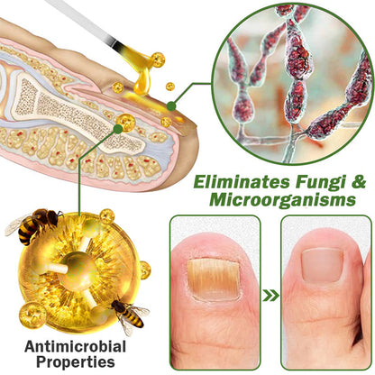 👩‍⚕️☁️Furzero™ Nail Defense Bee Venom Treatment Serum(For All Kinds Of Nail Diseases✅For Healthier Nail Growth)