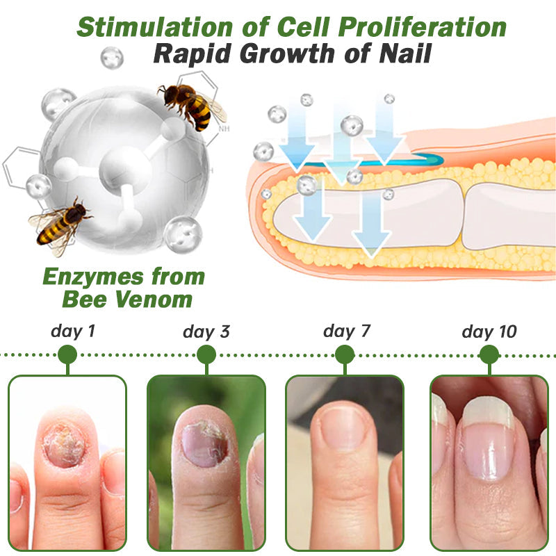 👩‍⚕️☁️Furzero™ Nail Defense Bee Venom Treatment Serum(For All Kinds Of Nail Diseases✅For Healthier Nail Growth)