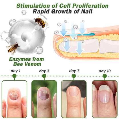 🌱👩‍⚕️Furzero™ Nail Defense Bee Venom Treatment Serum(For All Kinds Of Nail Diseases✅For Healthier Nail Growth)