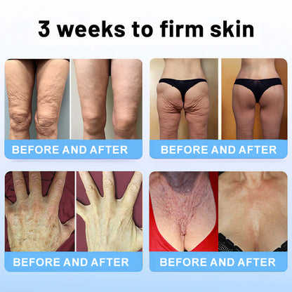 🏙️Flysmus® Skin Firming Cream,Addressing  Crepe ＆ Sagging
