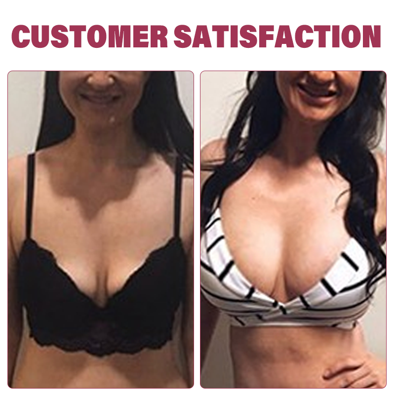 Sugoola™ Natural SizeUp Keratopeptide Protein Patch